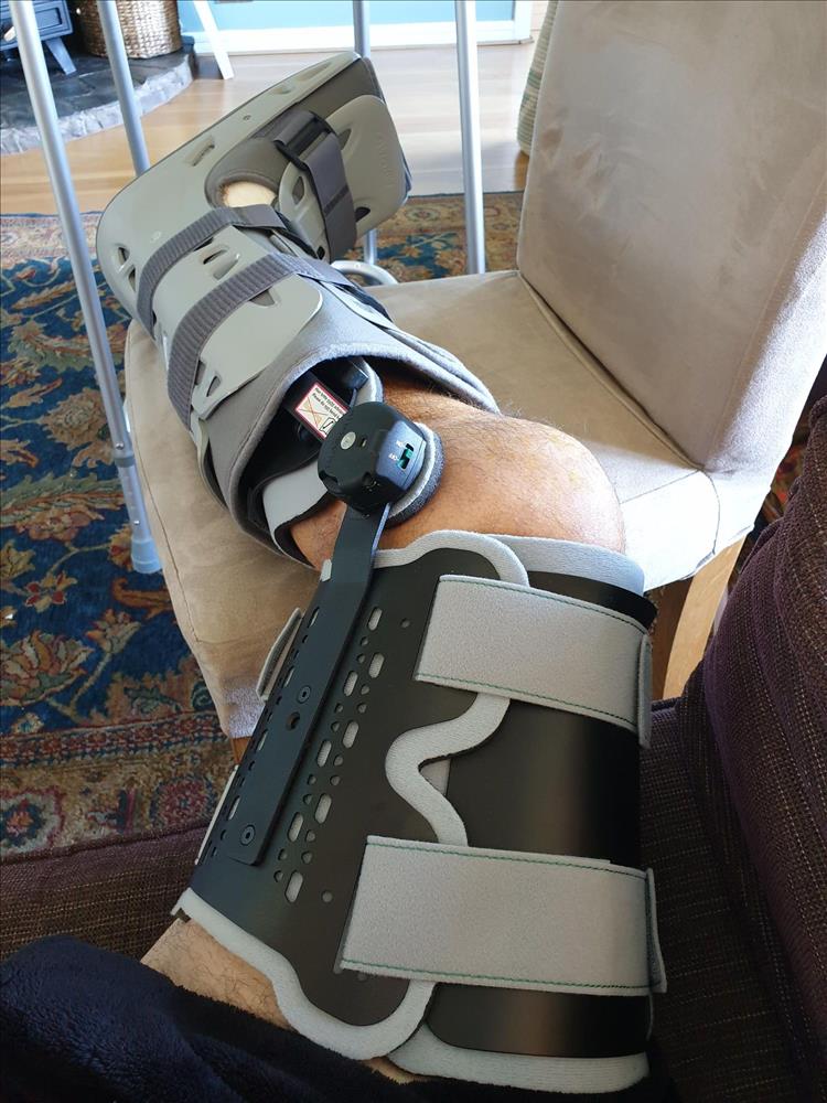 Pete's leg has a large metal brace fitted and a plastic boot to support the foot